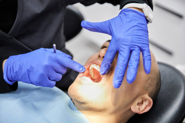 Best Urgent Care for Lost Fillings or Crowns in Oral City, FL